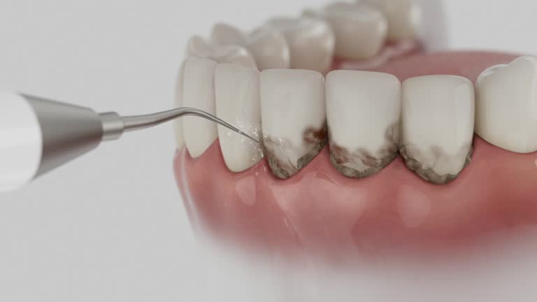 Trusted Teeth Cleaning And Checkup service in Ransomville, NY - Dentist Open Now